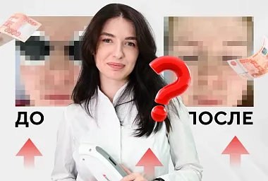 Розацеа - на стыке косметологии и медицины
